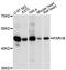 Parvin Beta antibody, A04707, Boster Biological Technology, Western Blot image 