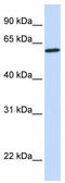 Sterol 26-hydroxylase, mitochondrial antibody, TA339940, Origene, Western Blot image 