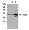 TP53 Induced Glycolysis Regulatory Phosphatase antibody, A05811, Boster Biological Technology, Western Blot image 