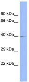 p84N5 antibody, TA345912, Origene, Western Blot image 