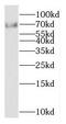 Potassium Voltage-Gated Channel Modifier Subfamily S Member 2 antibody, FNab04501, FineTest, Western Blot image 