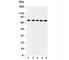 ATP Binding Cassette Subfamily G Member 2 (Junior Blood Group) antibody, R30968, NSJ Bioreagents, Western Blot image 