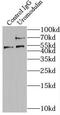 Tamm-Horsfall urinary glycoprotein antibody, FNab09294, FineTest, Immunoprecipitation image 
