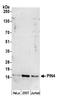 Peptidylprolyl Cis/Trans Isomerase, NIMA-Interacting 4 antibody, A305-660A-M, Bethyl Labs, Western Blot image 