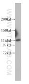 Importin 4 antibody, 11679-1-AP, Proteintech Group, Western Blot image 