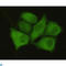 Protein Phosphatase 1 Catalytic Subunit Alpha antibody, LS-C813082, Lifespan Biosciences, Immunofluorescence image 