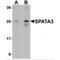 Spermatogenesis Associated 3 antibody, MBS150609, MyBioSource, Western Blot image 