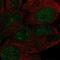 Zinc Finger Protein 429 antibody, PA5-64896, Invitrogen Antibodies, Immunofluorescence image 