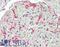 Mitogen-Activated Protein Kinase 9 antibody, LS-B11182, Lifespan Biosciences, Immunohistochemistry paraffin image 