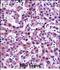 Nicotinamide N-Methyltransferase antibody, PA5-48630, Invitrogen Antibodies, Immunohistochemistry paraffin image 