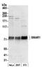 Protein BANP antibody, A300-279A, Bethyl Labs, Western Blot image 