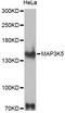 Mitogen-Activated Protein Kinase Kinase Kinase 5 antibody, LS-C747559, Lifespan Biosciences, Western Blot image 