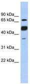 Nuclear factor of activated T-cells, cytoplasmic 1 antibody, TA330167, Origene, Western Blot image 