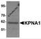 Karyopherin Subunit Alpha 1 antibody, 5981, ProSci Inc, Western Blot image 