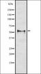4-Aminobutyrate Aminotransferase antibody, orb337060, Biorbyt, Western Blot image 