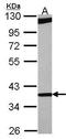 RNA-binding protein 4 antibody, TA308302, Origene, Western Blot image 