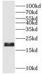Small Nuclear RNA Activating Complex Polypeptide 5 antibody, FNab08059, FineTest, Western Blot image 