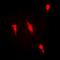 Protein arginine N-methyltransferase 2 antibody, orb340984, Biorbyt, Immunofluorescence image 