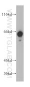 Butyrophilin Subfamily 3 Member A3 antibody, 15896-1-AP, Proteintech Group, Western Blot image 