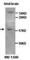 Calcium/Calmodulin Dependent Protein Kinase I antibody, orb77439, Biorbyt, Western Blot image 