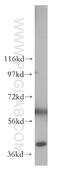 Pleckstrin 2 antibody, 11685-1-AP, Proteintech Group, Western Blot image 