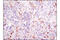 Lymphocyte Cytosolic Protein 1 antibody, 3588S, Cell Signaling Technology, Immunohistochemistry paraffin image 