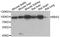 Bardet-Biedl syndrome 2 protein antibody, A7425, ABclonal Technology, Western Blot image 