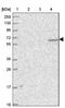 Kelch Like Family Member 35 antibody, NBP1-89837, Novus Biologicals, Western Blot image 
