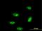TP53 Regulating Kinase antibody, MA5-22905, Invitrogen Antibodies, Immunofluorescence image 