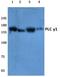 Phospholipase C Gamma 1 antibody, AP06287PU-N, Origene, Western Blot image 