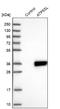 Distal Membrane Arm Assembly Complex 2 antibody, NBP2-14509, Novus Biologicals, Western Blot image 