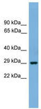 Basic Helix-Loop-Helix Family Member E23 antibody, TA329973, Origene, Western Blot image 
