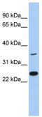 HAR antibody, TA341855, Origene, Western Blot image 