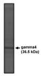 Calcium Voltage-Gated Channel Auxiliary Subunit Gamma 4 antibody, orb108862, Biorbyt, Western Blot image 