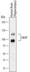 DLG Associated Protein 1 antibody, AF7296, R&D Systems, Western Blot image 