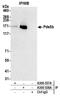 Sister chromatid cohesion protein PDS5 homolog B antibody, A300-538A, Bethyl Labs, Immunoprecipitation image 