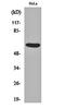 PHD Finger Protein 1 antibody, orb162366, Biorbyt, Western Blot image 