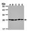 Proteasome 20S alpha 2 antibody, orb73732, Biorbyt, Western Blot image 