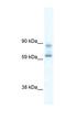 DEAD-Box Helicase 42 antibody, NBP1-57335, Novus Biologicals, Western Blot image 
