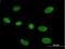 Ribonuclease P/MRP Subunit P40 antibody, H00010799-B01P, Novus Biologicals, Immunocytochemistry image 