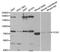 OCA2 Melanosomal Transmembrane Protein antibody, A5653, ABclonal Technology, Western Blot image 