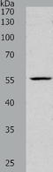 Paired Box 1 antibody, TA321752, Origene, Western Blot image 