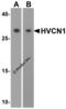 Hydrogen Voltage Gated Channel 1 antibody, 5875, ProSci, Western Blot image 