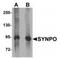 Synaptopodin antibody, NBP2-39100, Novus Biologicals, Western Blot image 