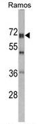 Probable ATP-dependent RNA helicase DDX5 antibody, AP17277PU-N, Origene, Western Blot image 