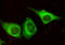 Keratin 7 antibody, LS-C178315, Lifespan Biosciences, Immunofluorescence image 