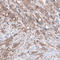 B-Raf Proto-Oncogene, Serine/Threonine Kinase antibody, AMAb91257, Atlas Antibodies, Immunohistochemistry frozen image 