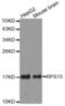 Ribosomal Protein S15 antibody, abx004554, Abbexa, Western Blot image 