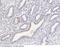 Carboxypeptidase M antibody, 11228-T24, Sino Biological, Immunohistochemistry paraffin image 