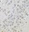 Down-Regulator Of Transcription 1 antibody, FNab02527, FineTest, Immunohistochemistry paraffin image 